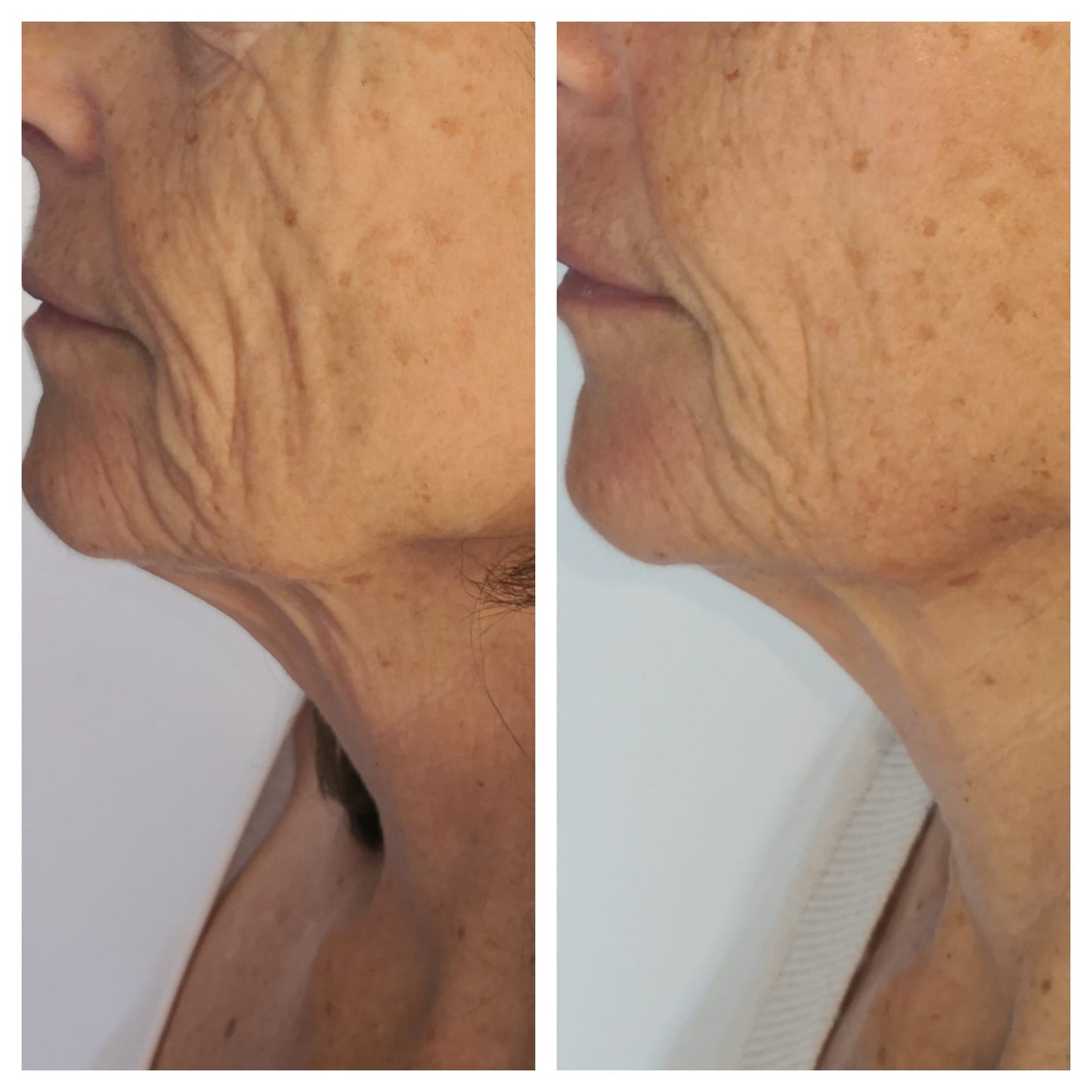 Masseur du cou et du visage à micro-courant - Boutique Ecom