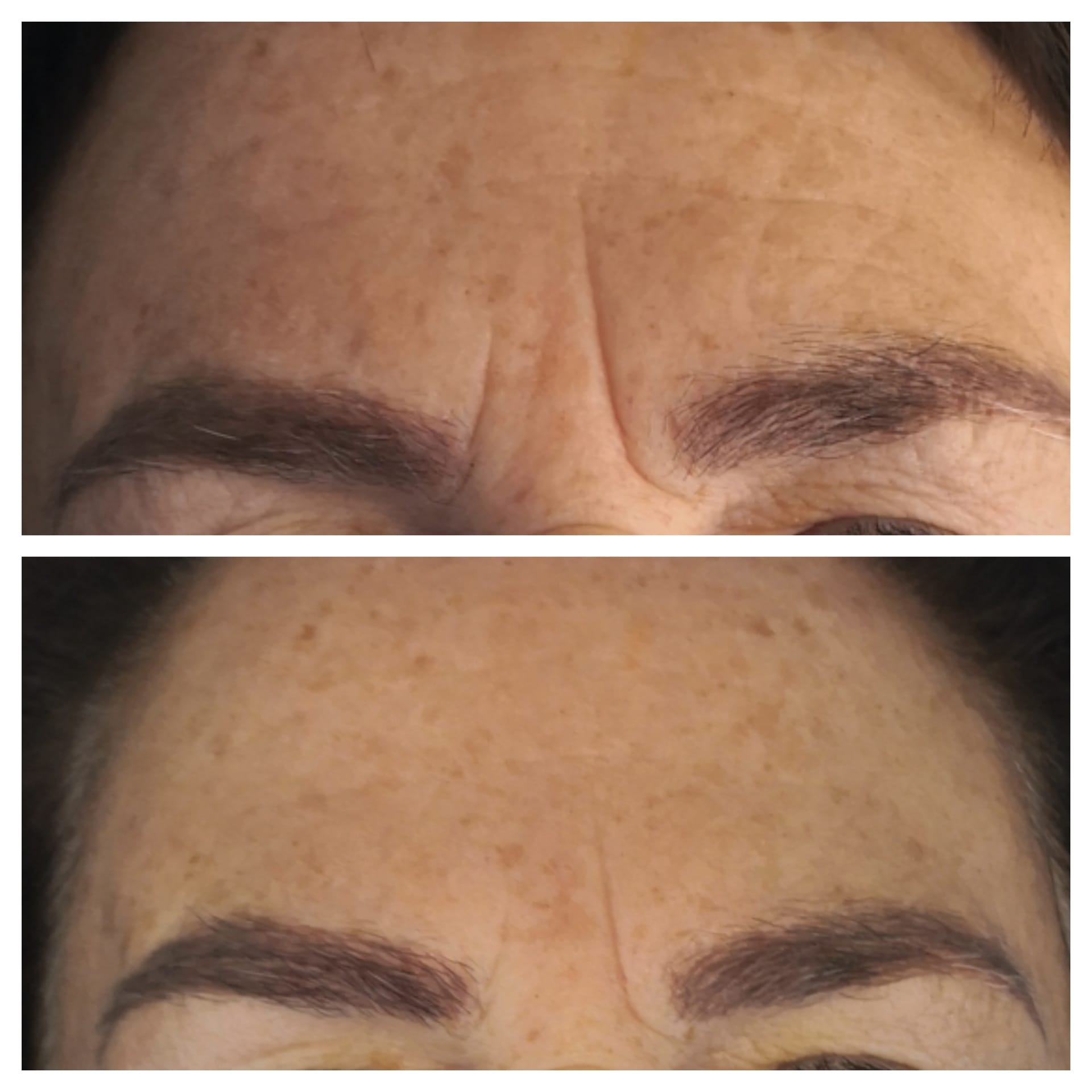 Masseur du cou et du visage à micro-courant - Boutique Ecom