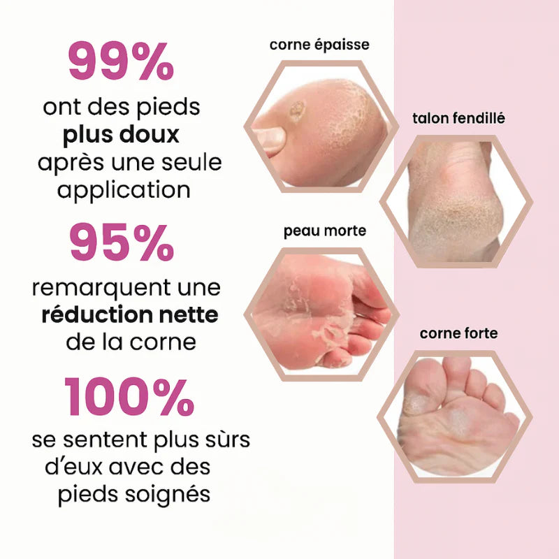 Anti-callosités - Boutique Ecom