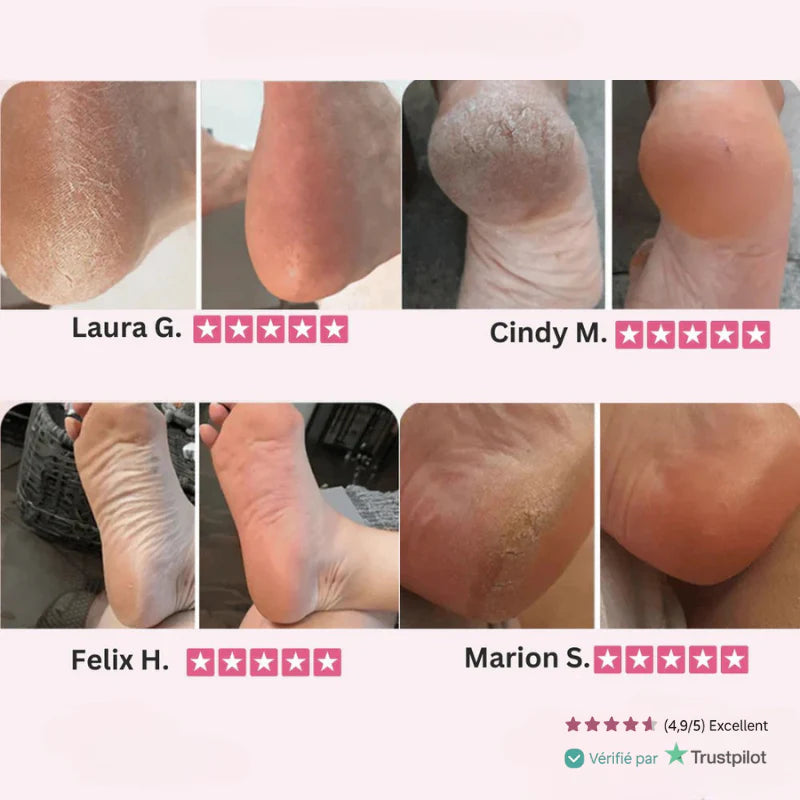 Anti-callosités - Boutique Ecom