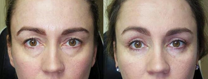 Capsules oculaires - Boutique Ecom